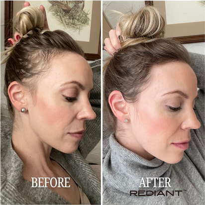 Rediant™ 3-in-1 Hair and Scalp Therapy Wand