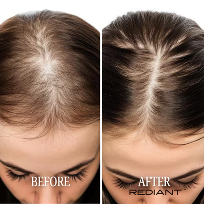 Rediant™ 3-in-1 Hair and Scalp Therapy Wand